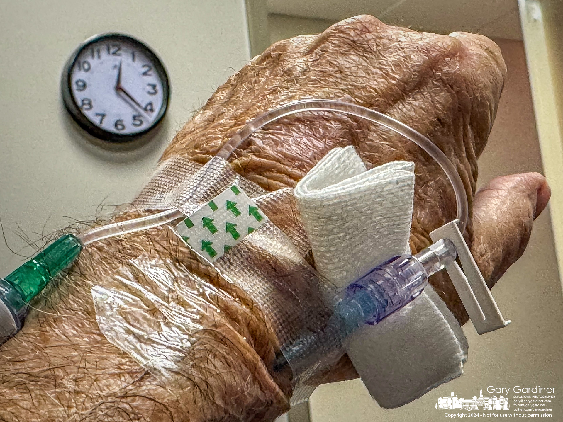 A photographer displays the IV to restore his fluids after a Christmas Day fight against pneumonia. My Final Photo for December 26, 2024.